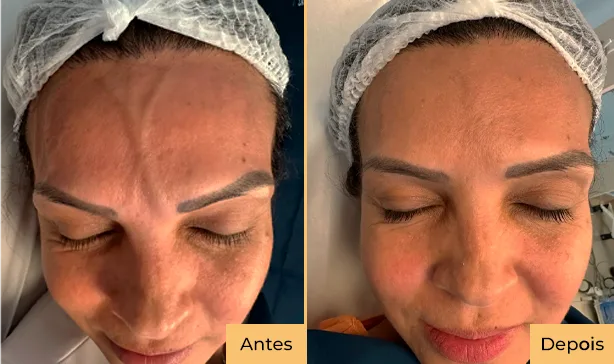 antes e depois foto 01