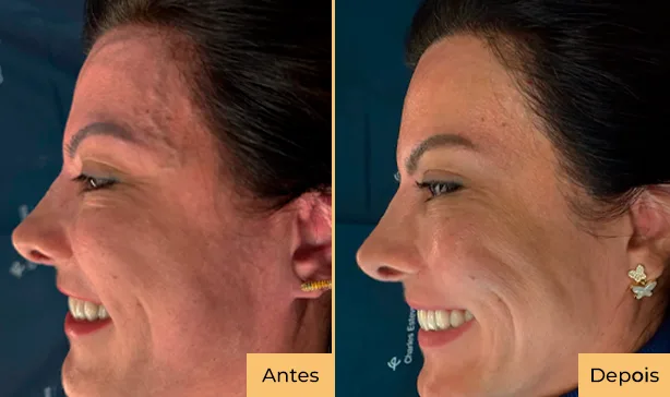 antes e depois foto 02