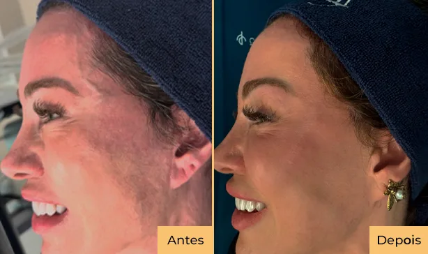 antes e depois - 03