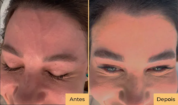 antes e depois 04